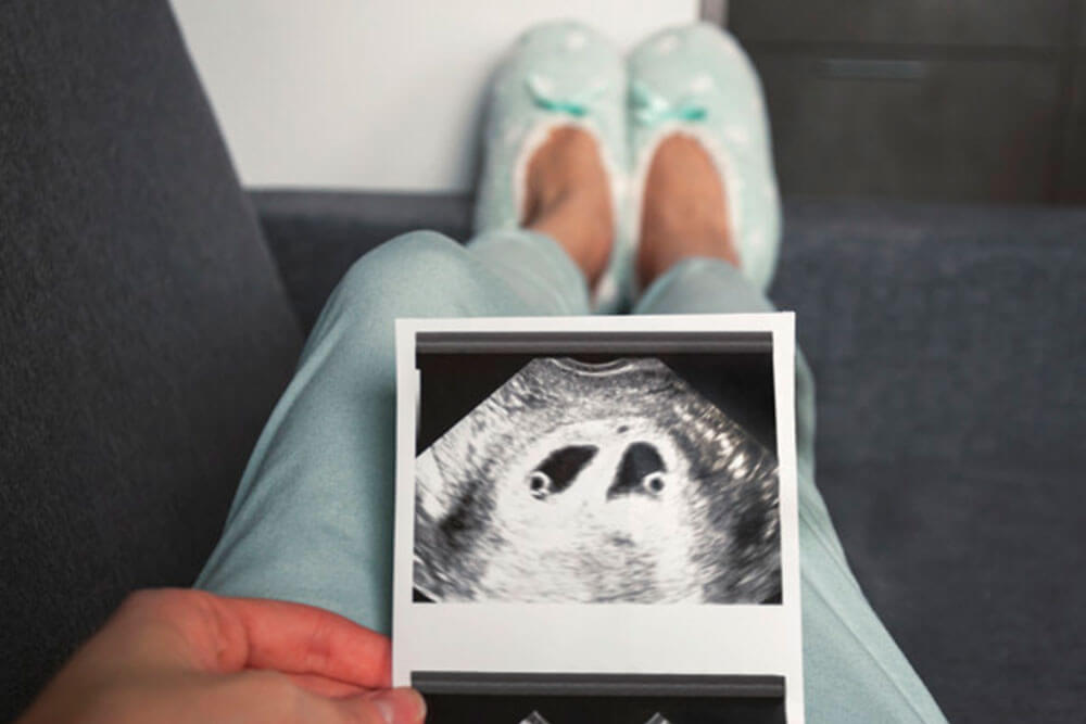 Sarcina gemelara si multipla si implicatii asupra fetilor si a mamemi - Dr. Ruxandra Albu - medic primar obstetrica - ginecologie si medicina materno - fetala. Doctor in stiinte medicale Femme Boutique Medical I Femmeboutiquemedical.com
