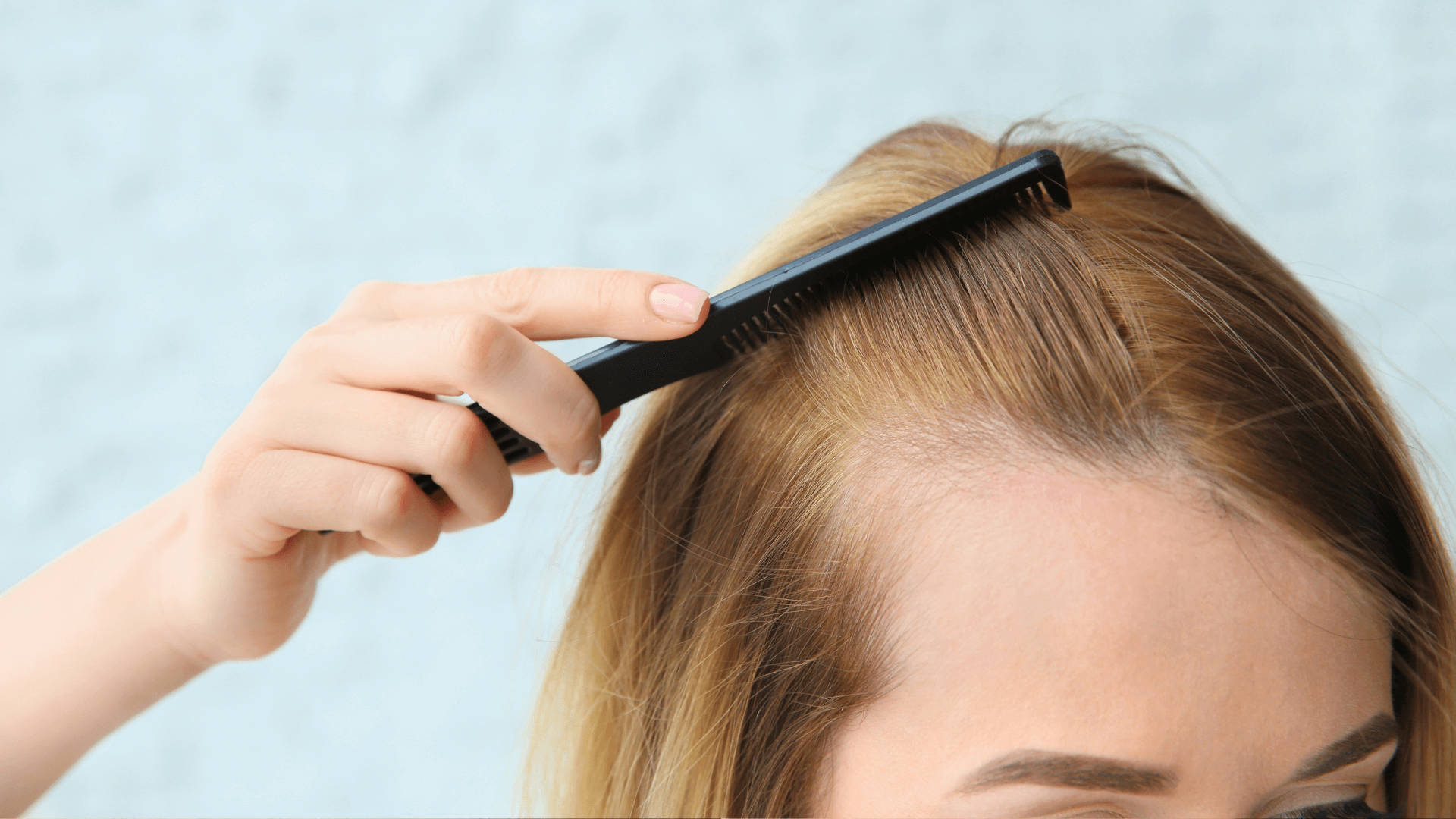 Căderea părului la perimenopauză și menopauză. Alopecia androgenetică feminină